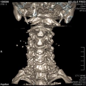ct scan pic